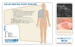 Preview for 15 page of NYSORA SIMULATORS DISTAL ADDUCTOR CANAL BLOCK Manual