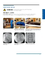 Preview for 13 page of OAKWORKS Spine Positioning System Instruction Manual