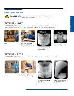 Preview for 15 page of OAKWORKS Spine Positioning System Instruction Manual