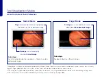 Preview for 4 page of Olympus ENDO-AID Quick Reference Manual