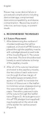 Предварительный просмотр 6 страницы On-X CHORD-X ePTFE SUTURE Instructions For Use Manual