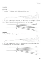 Предварительный просмотр 81 страницы On-X Chord-X Series Instructions For Use Manual