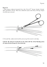 Предварительный просмотр 83 страницы On-X Chord-X Series Instructions For Use Manual