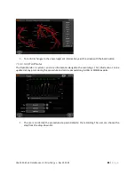 Preview for 84 page of Opsens F2300 Series Instructions For Use Manual