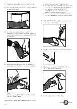 Preview for 3 page of orfit ORFITUBE ADJUSTER KIT Instructions For Use