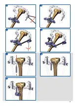 Предварительный просмотр 45 страницы Orthofix Galaxy-TL-HEX Manual