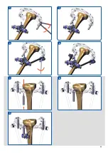Предварительный просмотр 48 страницы Orthofix Galaxy-TL-HEX Manual