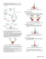 Предварительный просмотр 8 страницы Osprey Medical DyeVert Power XT Instructions For Use Manual