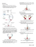 Предварительный просмотр 11 страницы Osprey Medical DyeVert Power XT Instructions For Use Manual