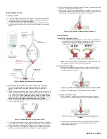 Предварительный просмотр 14 страницы Osprey Medical DyeVert Power XT Instructions For Use Manual