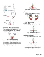 Предварительный просмотр 17 страницы Osprey Medical DyeVert Power XT Instructions For Use Manual