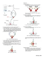 Предварительный просмотр 20 страницы Osprey Medical DyeVert Power XT Instructions For Use Manual