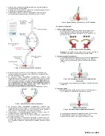 Предварительный просмотр 29 страницы Osprey Medical DyeVert Power XT Instructions For Use Manual