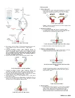 Предварительный просмотр 32 страницы Osprey Medical DyeVert Power XT Instructions For Use Manual