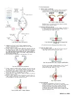 Предварительный просмотр 35 страницы Osprey Medical DyeVert Power XT Instructions For Use Manual