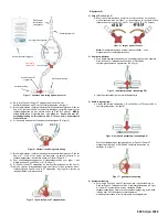 Предварительный просмотр 38 страницы Osprey Medical DyeVert Power XT Instructions For Use Manual