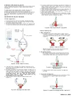 Предварительный просмотр 41 страницы Osprey Medical DyeVert Power XT Instructions For Use Manual