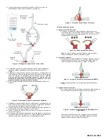 Предварительный просмотр 44 страницы Osprey Medical DyeVert Power XT Instructions For Use Manual