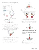 Предварительный просмотр 47 страницы Osprey Medical DyeVert Power XT Instructions For Use Manual