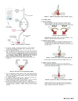 Предварительный просмотр 50 страницы Osprey Medical DyeVert Power XT Instructions For Use Manual