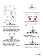 Предварительный просмотр 53 страницы Osprey Medical DyeVert Power XT Instructions For Use Manual