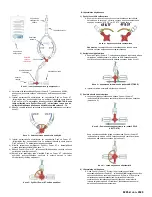 Предварительный просмотр 56 страницы Osprey Medical DyeVert Power XT Instructions For Use Manual