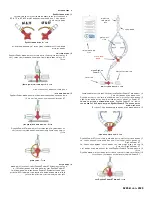 Предварительный просмотр 59 страницы Osprey Medical DyeVert Power XT Instructions For Use Manual