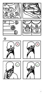 Preview for 4 page of Ossur MIAMI J SELECT Instructions For Use Manual