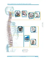 Preview for 26 page of Ossur Miami Lumbar Posteo Technical Manual