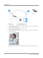 Preview for 34 page of otometrics ABR Screener User Manual