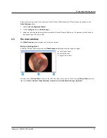 Предварительный просмотр 11 страницы otometrics AURICAL OTOCAM 300 Reference Manual