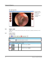 Предварительный просмотр 12 страницы otometrics AURICAL OTOCAM 300 Reference Manual