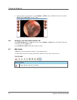 Предварительный просмотр 14 страницы otometrics AURICAL OTOCAM 300 Reference Manual