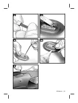 Preview for 3 page of Otto Bock 13E202 50 Instructions For Use Manual