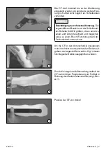 Preview for 7 page of Otto Bock 17CF1 Series Instructions For Use Manual