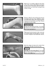 Preview for 19 page of Otto Bock 17CF1 Series Instructions For Use Manual