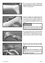 Preview for 30 page of Otto Bock 17CF1 Series Instructions For Use Manual