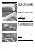 Preview for 41 page of Otto Bock 17CF1 Series Instructions For Use Manual