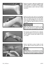 Preview for 52 page of Otto Bock 17CF1 Series Instructions For Use Manual