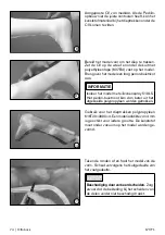 Preview for 74 page of Otto Bock 17CF1 Series Instructions For Use Manual