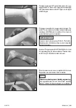 Preview for 85 page of Otto Bock 17CF1 Series Instructions For Use Manual