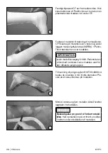 Preview for 96 page of Otto Bock 17CF1 Series Instructions For Use Manual