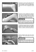 Preview for 118 page of Otto Bock 17CF1 Series Instructions For Use Manual