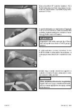 Preview for 129 page of Otto Bock 17CF1 Series Instructions For Use Manual