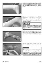 Preview for 140 page of Otto Bock 17CF1 Series Instructions For Use Manual