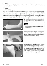 Preview for 160 page of Otto Bock 17CF1 Series Instructions For Use Manual