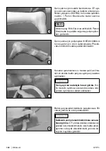 Preview for 162 page of Otto Bock 17CF1 Series Instructions For Use Manual