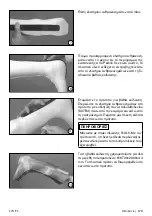 Preview for 173 page of Otto Bock 17CF1 Series Instructions For Use Manual