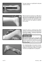 Preview for 185 page of Otto Bock 17CF1 Series Instructions For Use Manual