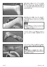 Preview for 197 page of Otto Bock 17CF1 Series Instructions For Use Manual